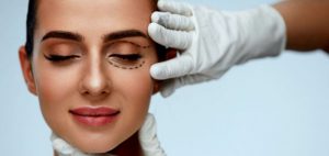antes y después de la Blefaroplastia-madrid