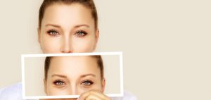 blefarolaser-tratamientos-con-laser-madrid