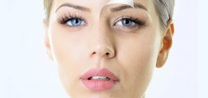 efectos-rejuvenecimiento-facial-prp-madrid