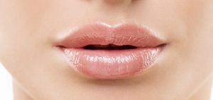 feminizacion-facial-elevacion-aumento-de-labios-madrid