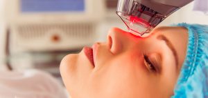laser-CO2-rejuvenecimiento-facial-sin-cirugia-madrid