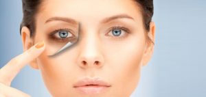 quitar-ojeras-con-laser-madrid