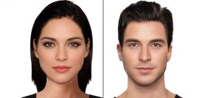 remodelado-frontoorbitario-lifting-de-cejas-madrid