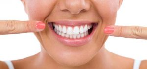 sonrisa-gingival