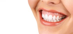 sonrisa-gingival-cirugia-ortognatica