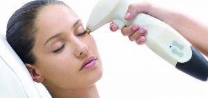 tratamiento-de-las-ojeras-con-laser-madrid